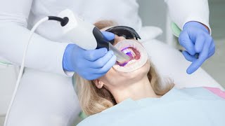 Veneers  Die Lösung für perfekte Zähne Erfahren Sie alles über die dünnen Zahnschalen [upl. by Navak]