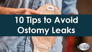 Common Ostomy Issues My Ostomy Bag Keeps Leaking [upl. by Pelagia712]