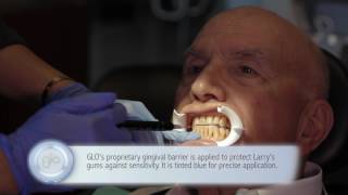 GLO Science Professional  Chairside Whitening with Larry Cohen [upl. by Lin]