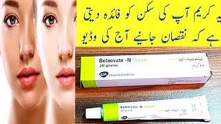 How To Use Betnovate N Cream Urdu [upl. by Corabella]