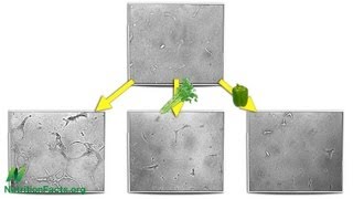 AntiAngiogenesis Cutting Off Tumor Supply Lines [upl. by Ahseket]