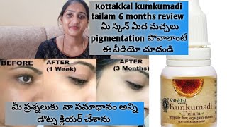 Kumkumadi Tailam Review After Using 6 months  Kottakkal Kumkumadi Tailam I Sujay Vlogs [upl. by Lyrej410]