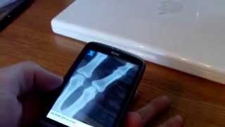 XRay Scanner for Android [upl. by Ansell]