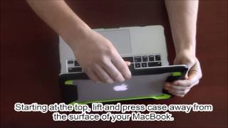 Macbook Armorbox Installation Video  IBlason [upl. by Arehc]