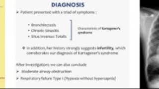 kartagner syndrome متلازمة كارتجنر انعدام حركة الاهداب الأولي [upl. by Aenat]