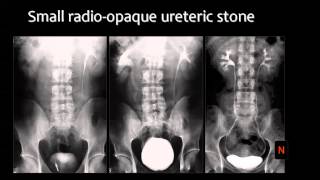 Urinary System Radiology Arabic  Prof Mamdouh Mahfouz [upl. by Romeon]