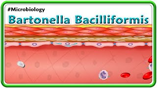 Bartonella Bacilliformis Animation Carrions disease  Oroya fever  verruga peruana USMLE Step 1 [upl. by Olmsted]