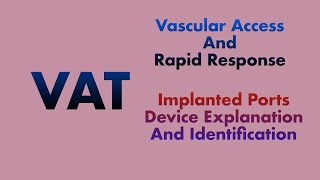 Implanted Ports Device Explanation and identification [upl. by Solley582]