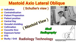 Mastoid Axio Lateral Oblique view  Schullers View in Hindi  Mastoid View [upl. by Ayaj]