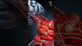 Science Of Stroke stroke shorts strokeeducation strokesupport [upl. by Adnorrehs66]