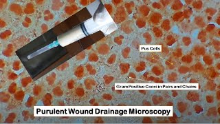 Purulent Wound Drainage under the Microscope [upl. by Ziwot]