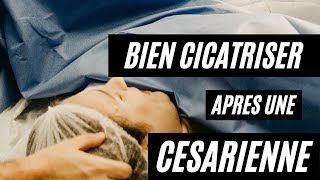 Comment cicatriser plus vite après une césarienne [upl. by Larrad545]