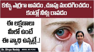 Uveitis Causes Symptoms and Treatment In Telugu  కంటిలో నల్ల మచ్చలు  Best Vision Eye Hospital [upl. by Smart340]