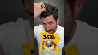 Hair Loss How to Stop Hair Loss amp Enhance Fuller Hair  Ultimate Hair Growth Solution  InvisaBlend [upl. by Loresz143]