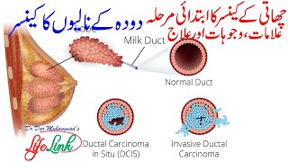 Ductal Carcinoma in Situ DCIS  Successful Natural Treatment of Breast Cancer [upl. by Irama808]