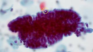 Cervical cytology  Endocervical cells [upl. by Rapsag227]