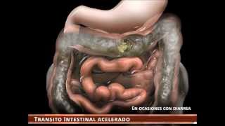 sindrome de intestino irritable [upl. by Avla]