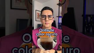 ¡Alerta Orina color oscuro coluria estas son sus causas  Dr William Guerrero medicina shorts [upl. by Coralie]