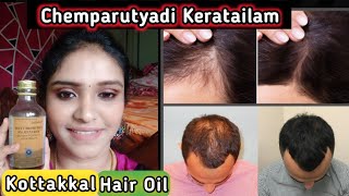 தமிழில் Kottakkal Chemparutyadi Keratailam Review  Hair growth Treatment  Seborrheic dermatitis [upl. by Llewop]