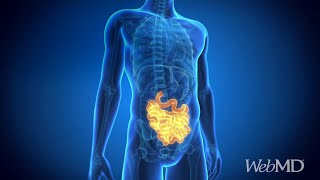 Facts About Your Intestines  WebMD [upl. by Lam]