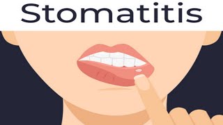 stomatitiscauses of stomatitissymptoms of stomatitisshort [upl. by Jaela]