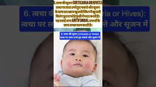 CPM Syrup for Pediatrics।Bachho ki Syrup।Uses in Hindi।How to uses।CPM Avil syrup Alerid Shorts [upl. by Aissilem]