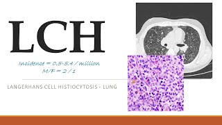 LCH  Unraveling LANGERHANS CELL HISTIOCYTOSIS A Comprehensive Guide [upl. by Odlaumor540]