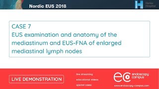 Livedemo  Nordic EUS 2018  EUS examination and anatomy of the mediastinum [upl. by Grath]