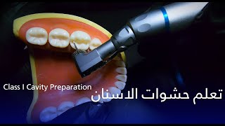 اسهل تدريب لتعلم حشوات الاسنان  Class I Cavity Preparation [upl. by Ainosal578]