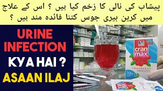 Cran Max Sachet Uses amp Benefits  Cranberry Juice Benefits In Urdu Hindi  Urinary Tract Infection [upl. by Lanctot]