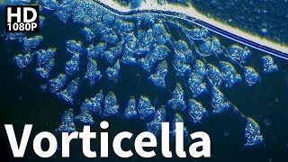 Vorticella Under Microscope [upl. by Georg]