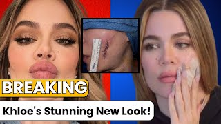 Khloe Kardashians SHOCKING Transformation After Tumor Removal Photos Go Viral [upl. by Anaoy297]