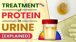 Treatment Of Protein In Urine Explained [upl. by Lamarre]