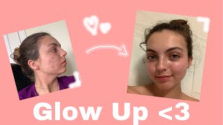 COMMENT JAI ÉLIMINÉ MON ACNÉ II SKINCARE ROUTINE  epiduo [upl. by Hoj]