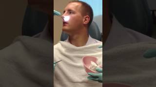 Septoplasty and Turbinate Reduction Splint Removal [upl. by Otineb]