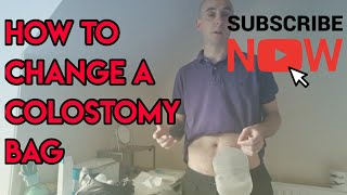 How to change a colostomy stoma bag [upl. by Ahsinroc750]