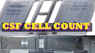 CSF CELL COUNT [upl. by Blood836]