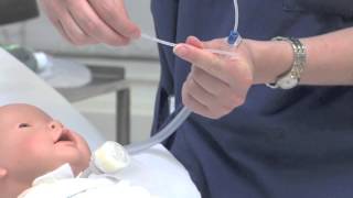 Tracheostomy Suctioning [upl. by Niarbo]