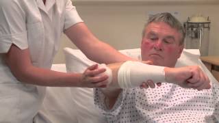 Pressure Ulcer Prevention ADERMA◊ Dermal Pad Elbow Application [upl. by Pilif]