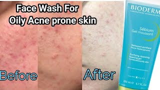 Face wash for Acne Control amp Acne Bioderma sebum Gel Moussant Cleanser for oily amp Acne prone skin [upl. by Namso814]