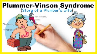 Plummer Vinson Syndrome  Story of a Plumbers wife [upl. by Welch]