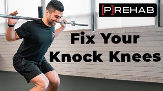 Fixing Your Knock Knees With Two Exercises [upl. by Jermain774]