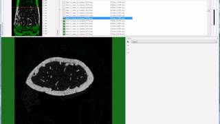 Bruker microCT tutorial Setting the trabecular VOI for the mouse femur [upl. by Akinohs]