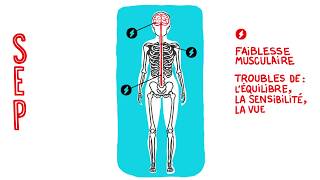 Comprendre la SEP en animation vidéo [upl. by Irt821]