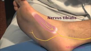 Motorische Neurographie  Tibialis [upl. by Lydie]