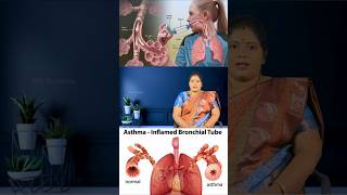 ஆஸ்துமா இருந்தால் இப்படியெல்லாம் ஆகுமா 😳 Asthma [upl. by Selwyn504]