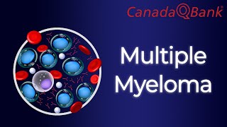 Multiple Myeloma [upl. by Kenny71]