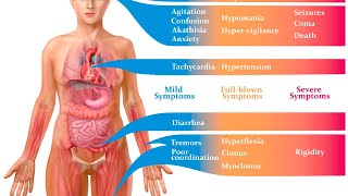 Serotonin Syndrome CyproheptadineSymptoms of Serotonin syndromeSerotonin syndrome in Urdu [upl. by Yhtir114]