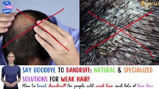 How to treat dandruff for people with weak hair and lots of hair loss haircare hairloss dandruff [upl. by Marjory]