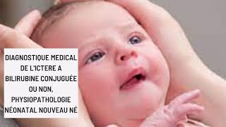 Diagnostique Medical de lictere a bilirubine conjuguée ou non physiopathologie néonatal nouveau né [upl. by Nylinnej624]